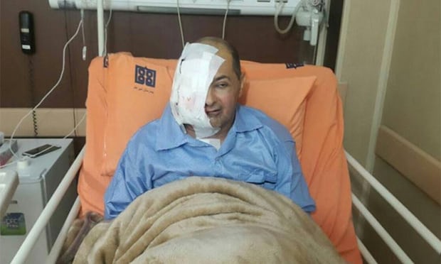 Іранський журналіст втратив око через відсутність лікування у в’язниці